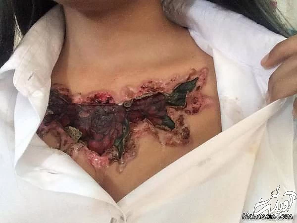 عاقبت تاتو رنگی روی بدن زن